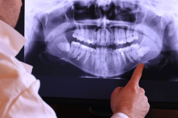 Best Dental Abscess Treatment in East Camden, SC